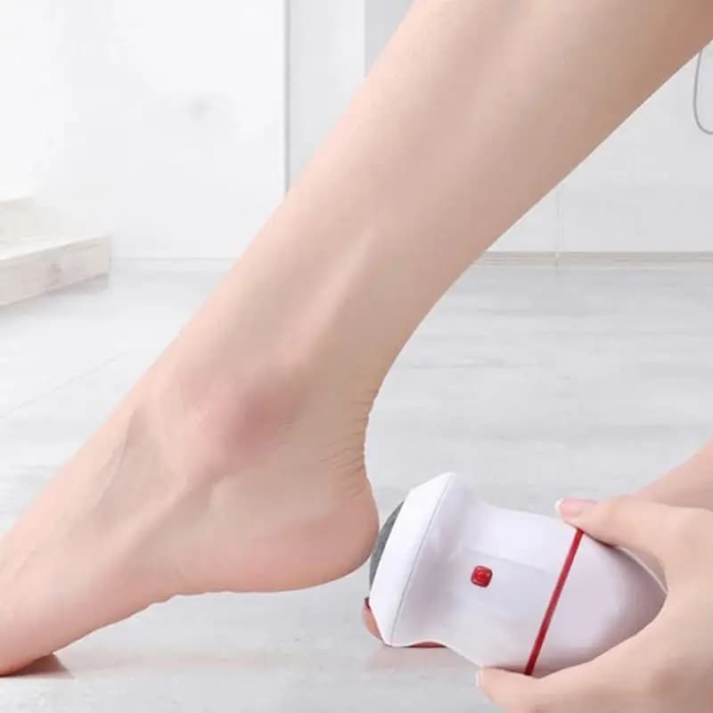 Callus Remover
