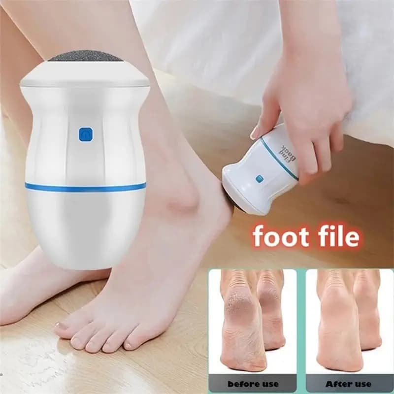 Callus Remover